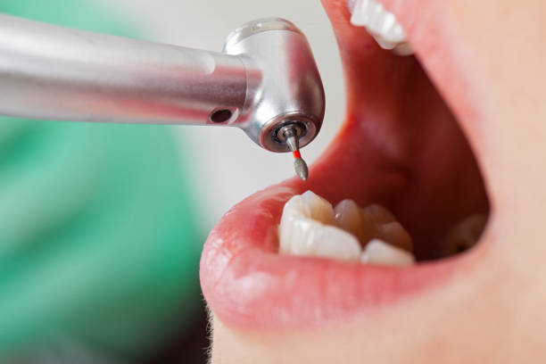 Best Weekend Emergency Dentist in Hannibal, MO